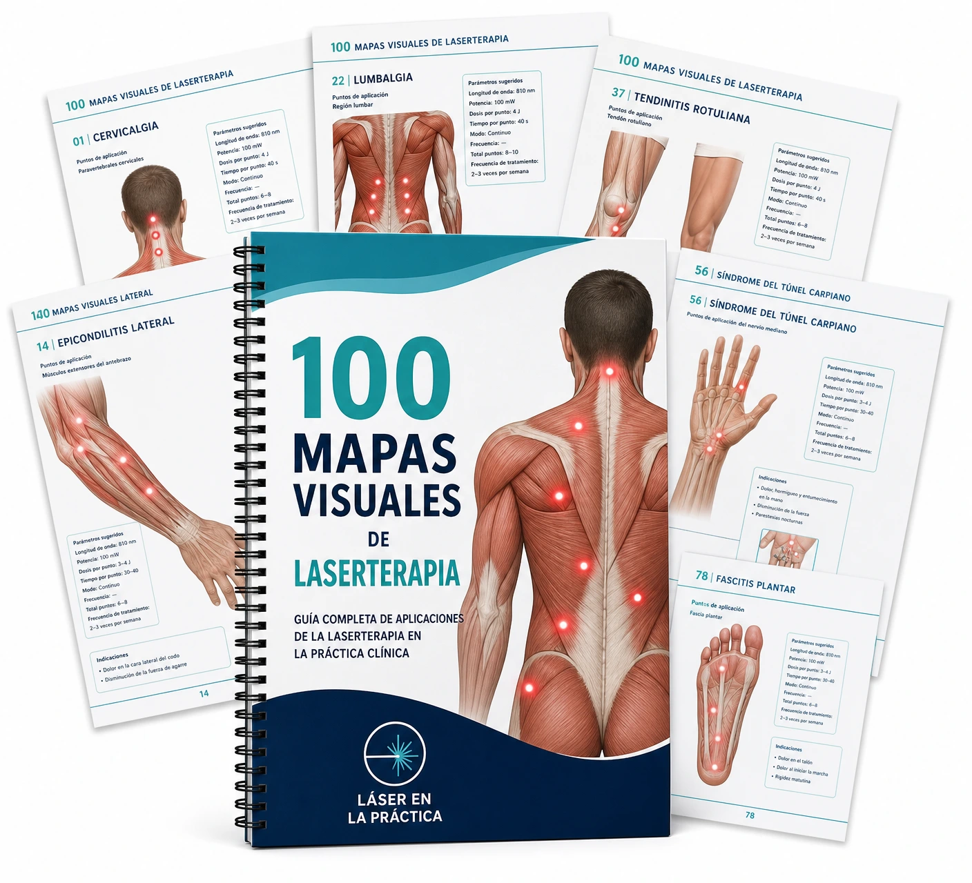 100 Mapas Visuales de Laserterapia